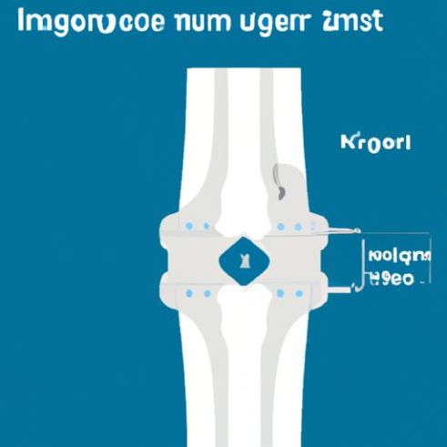 Penahan pelindung immobilizer penyangga penyangga sendi lutut berengsel Lutut ortopedi medis